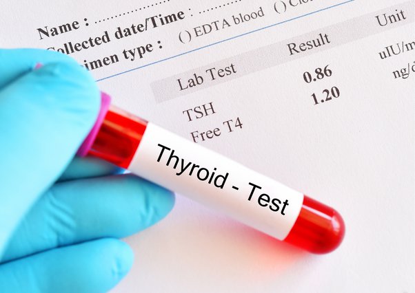 thyroid blood test