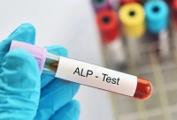 فسفاتاز قليايي ALP